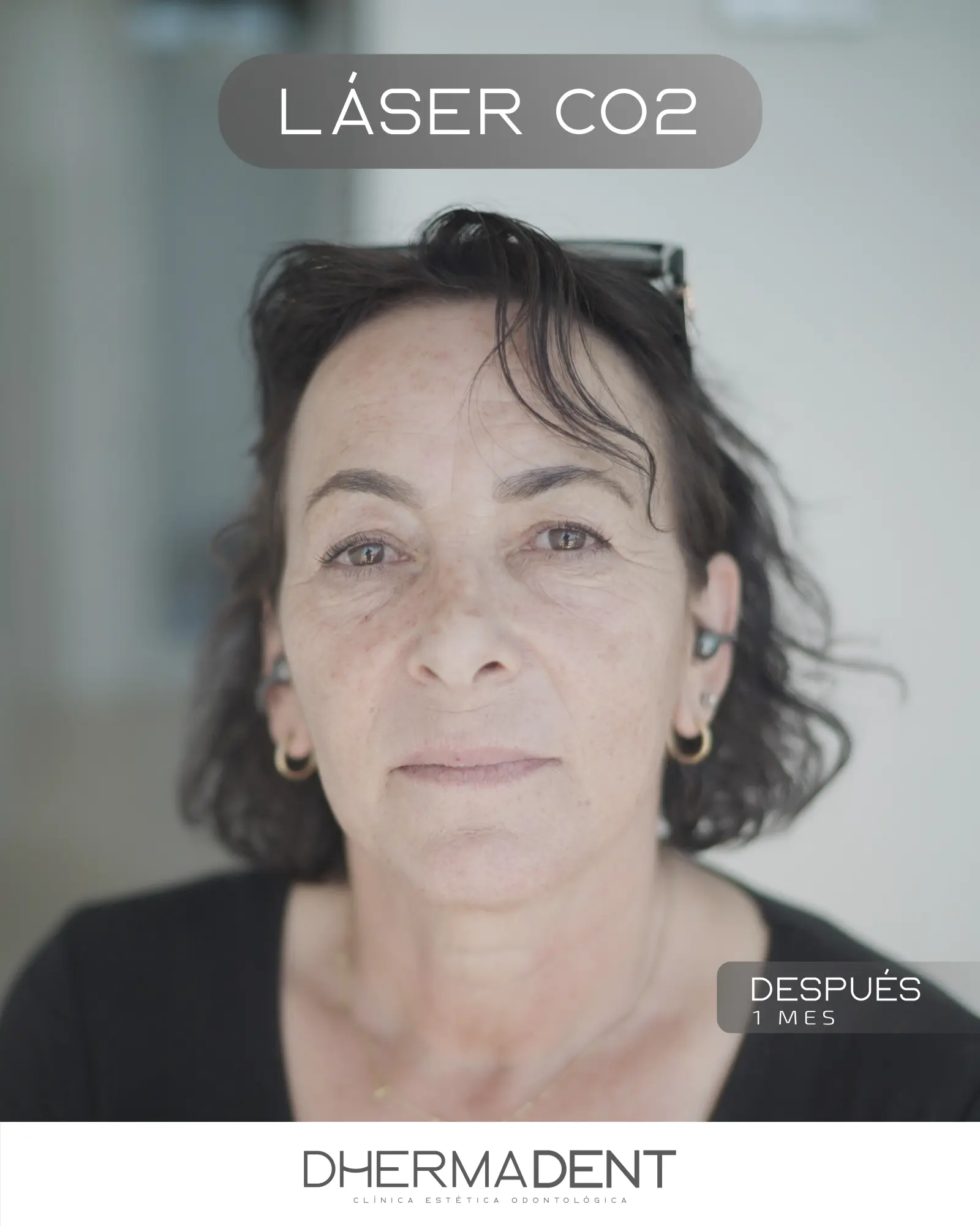 Después